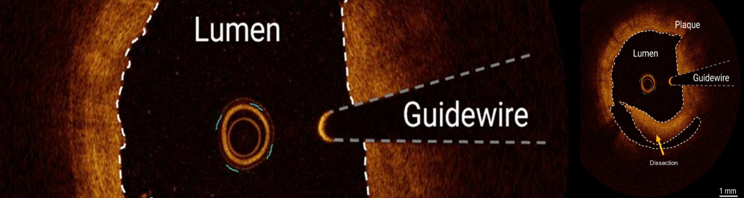 PPS-Innovatieregeling (vanaf 2024)