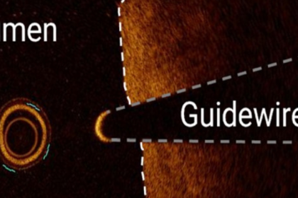 PPS-Innovatieregeling (vanaf 2024)